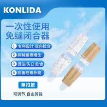 伤口减张缝合器妇科手术愈合免拆线皮肤拉链式减张器术后伤口护理