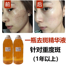 祛斑原液 美白淡斑去黑色素修护滋养水控色液 精选熊果苷精华原液