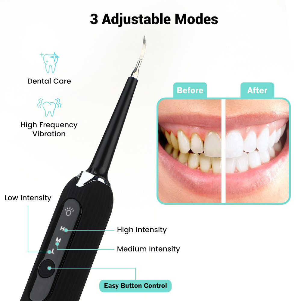 Ultrasonic Toothbrush Image 3