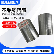 定制矿筛管绕丝约翰逊筛管水井防砂滤管不锈钢楔形丝滤芯化工滤网