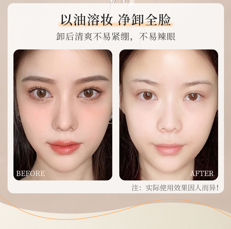 Mingxi Zhi Makeup Remover Water, makeup Remover oil, eye, lip and face three-in-one, gentle and non-irritating makeup remover liquid, rejuvenating cleansing oil, cross-border undefined