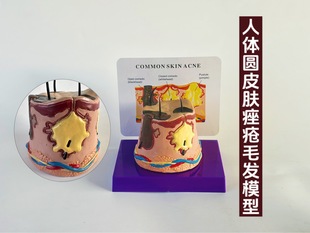 Three-dimensional skin tissue structure enlargement model hierarchical human body structure layered anatomy mold beauty plastic hair