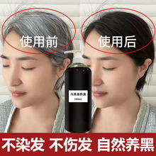 何首乌白转黑精华液头发滋养液乌发护发防脱育发液白发养黑发原液