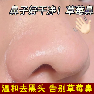 Blackhead Extract Liquid Blackhead Decontamination Hospital Small Bubbles for acne Purifying Hair Follicle Softening Corneous Pore Shrinking Essence