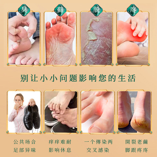 Rongzuotang Foot Spray 20ml Foot Care Spray Oxygen-Less Cracked Skin Foot Steam Mist, One Piece Dropshipping