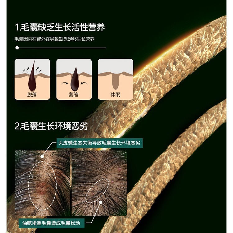 緑檀牛角櫛指櫛マッサージ頭皮ヘアケア経絡櫛家庭用ハゲ防止ヘッド多機能ヘッド櫛|undefined