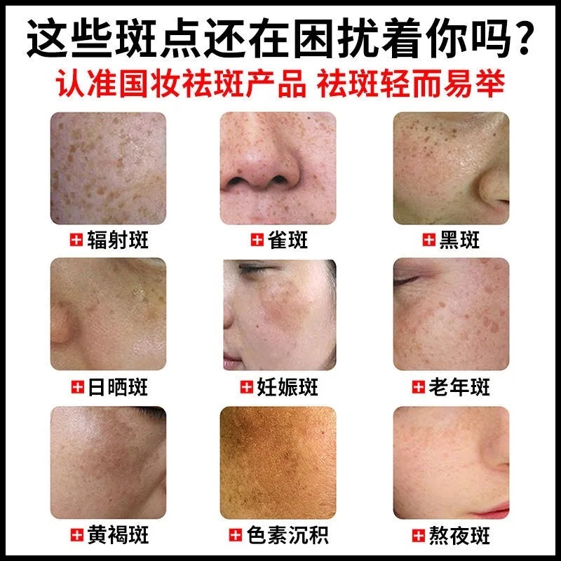 熊果配糖体はぶちを取り除きます。美容院の美白は薄いぶちを取り除きます。|undefined