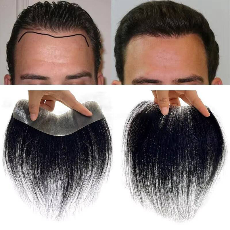 Seamless Ultra-Thin Transparent Pu Men's Real Hair Forehead Hairline Replacement Piece 2X16/3X17/4X18Cm Wig Seamless Ultra-Thin Transparent Pu Men's Real Hair Forehead Hairline Replacement Piece 2X16/3X17/4X18Cm Wig