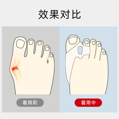 Cross-border SEBS thumb valgus toe corrector for men and women adult big foot bone daily toe separator gel thumb