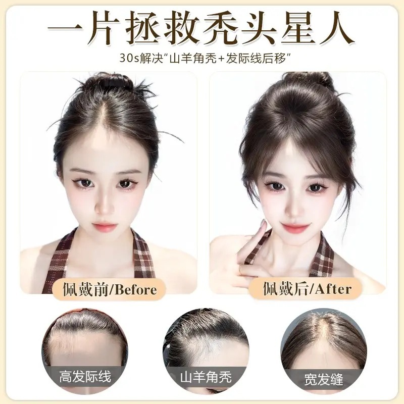 【凉感冰皮】假发片头顶全真人发饰夏季轻薄假刘海补发片透气无痕|undefined