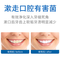 Bisu Tang Probiotic Mouthwash for Bacteria Removal and Bad Breath Elimination with Long-lasting Fragrance, Suitable for Men and Women, Portable 500ML