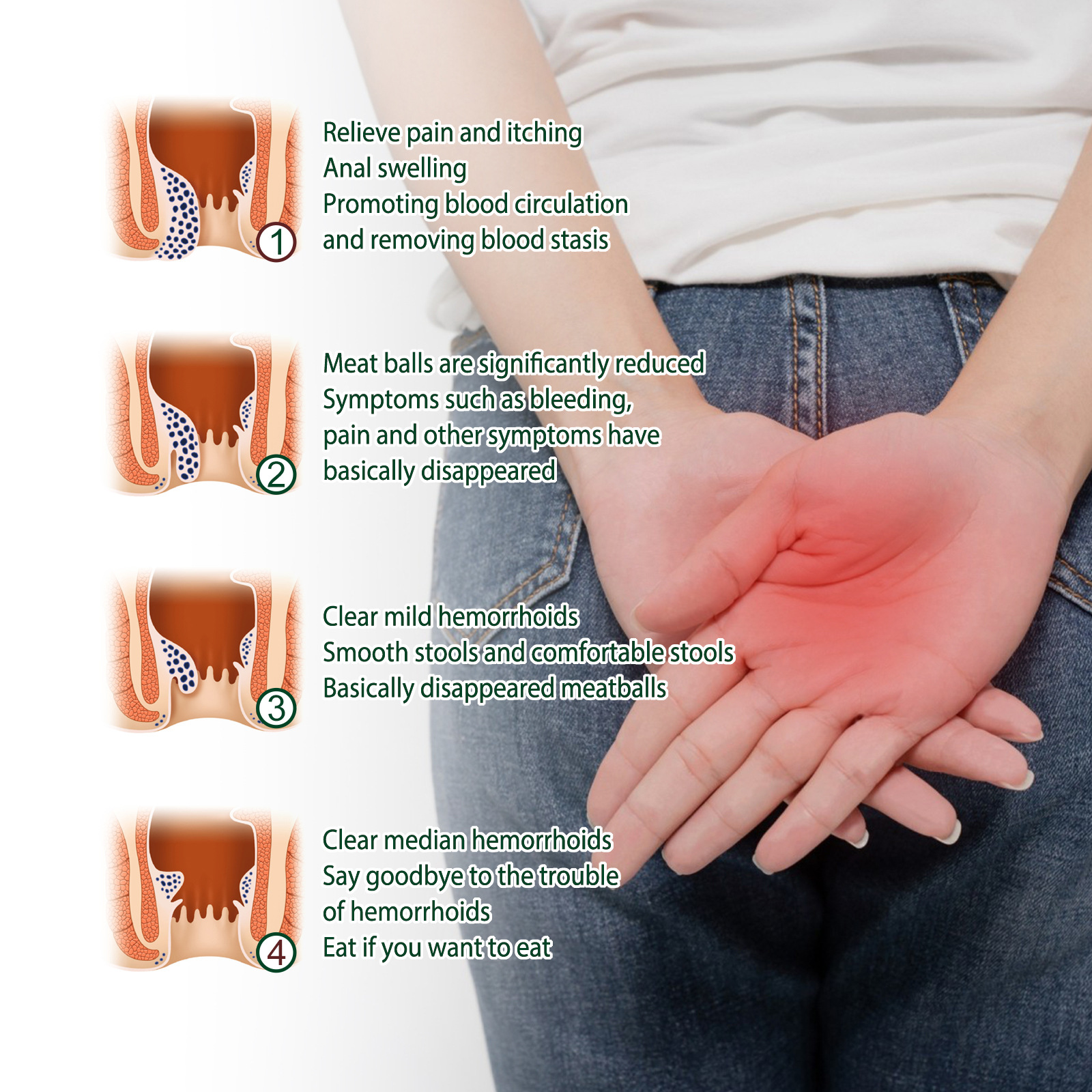 South Moon hemoroīdu noņemšanas kotlešu tūpļa komforta kopšanas ziede, mazina niezi, pietūkumu un sāpes_voghion.com