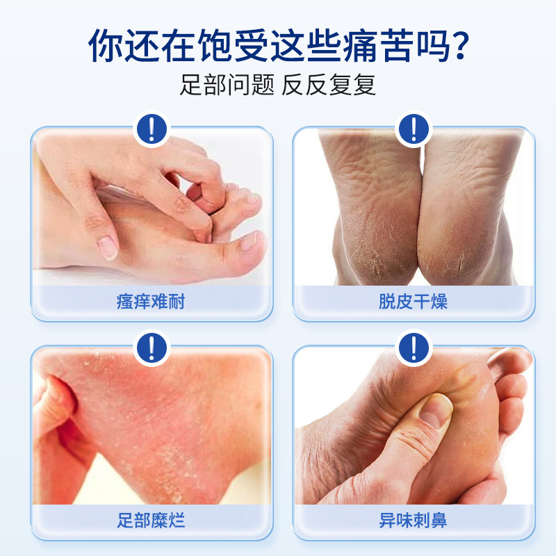 狼毒爽脚液脚痒脚臭喷雾足部护理净液除臭脱皮止痒喷剂|undefined