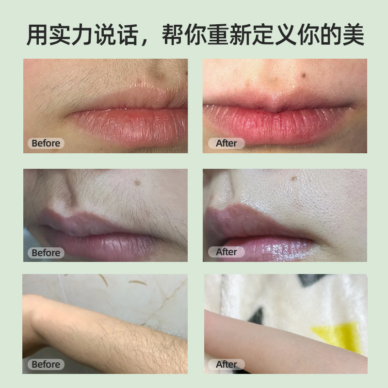 源头工厂家用手持数显无痛激光脱毛仪 电动激光女用全身脱毛器