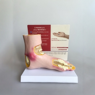 Human Anatomy Model, Medical Teaching Model, Foot Pathology Model