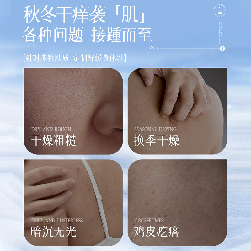 Auonam Calamine Calming Emulsion Refrescante Otoño Invierno Mejora la piel seca, suave, hidratante y rejuvenecedor Fabricante