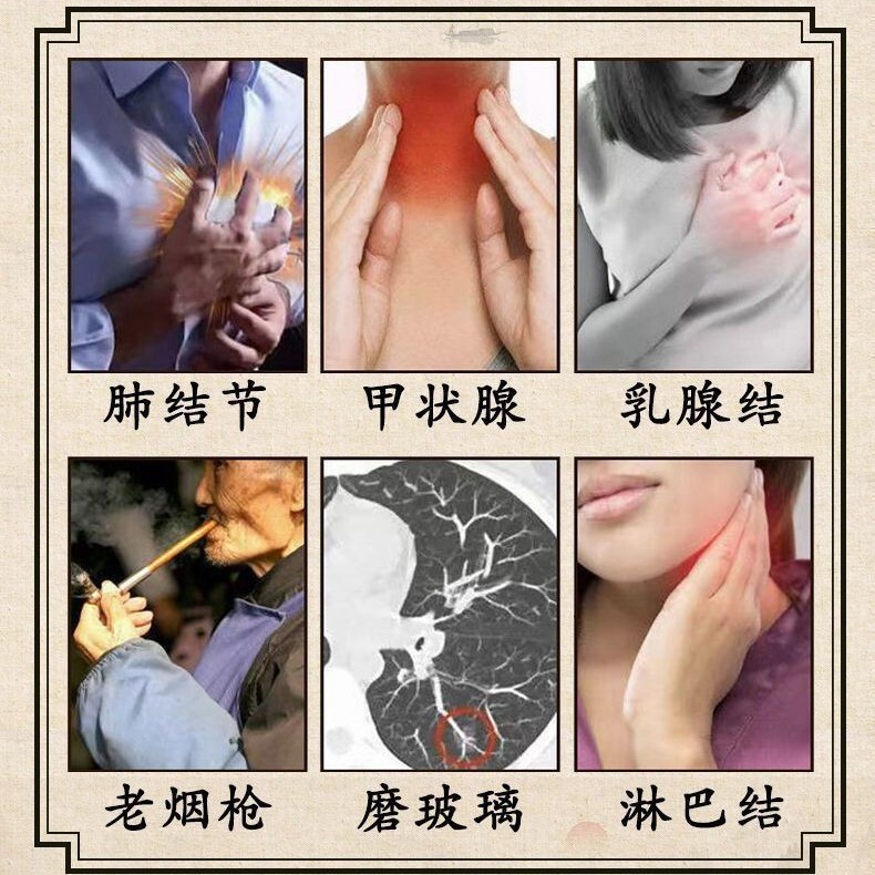 御方散結霊椎名製薬漢方薬内調消節古方配合調理通散結顆粒公式代発|undefined