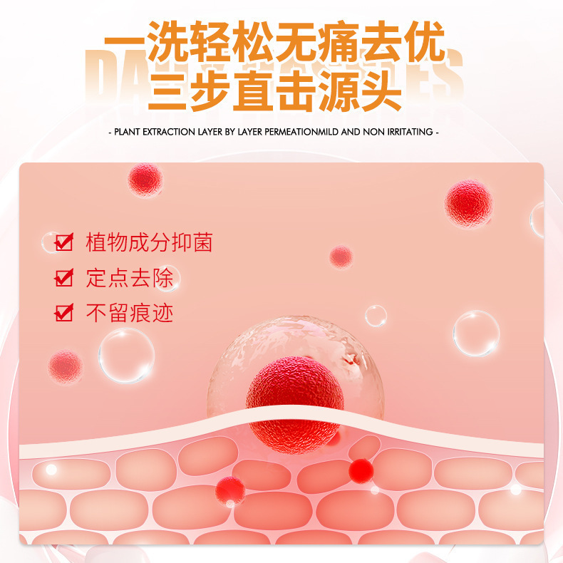 香港薬局の疣贅石鹸は全身に使用でき、痒みを和らげるために使用できます。猿の小さな肉粒をきれいにする手作り石鹸の卸売です。|undefined