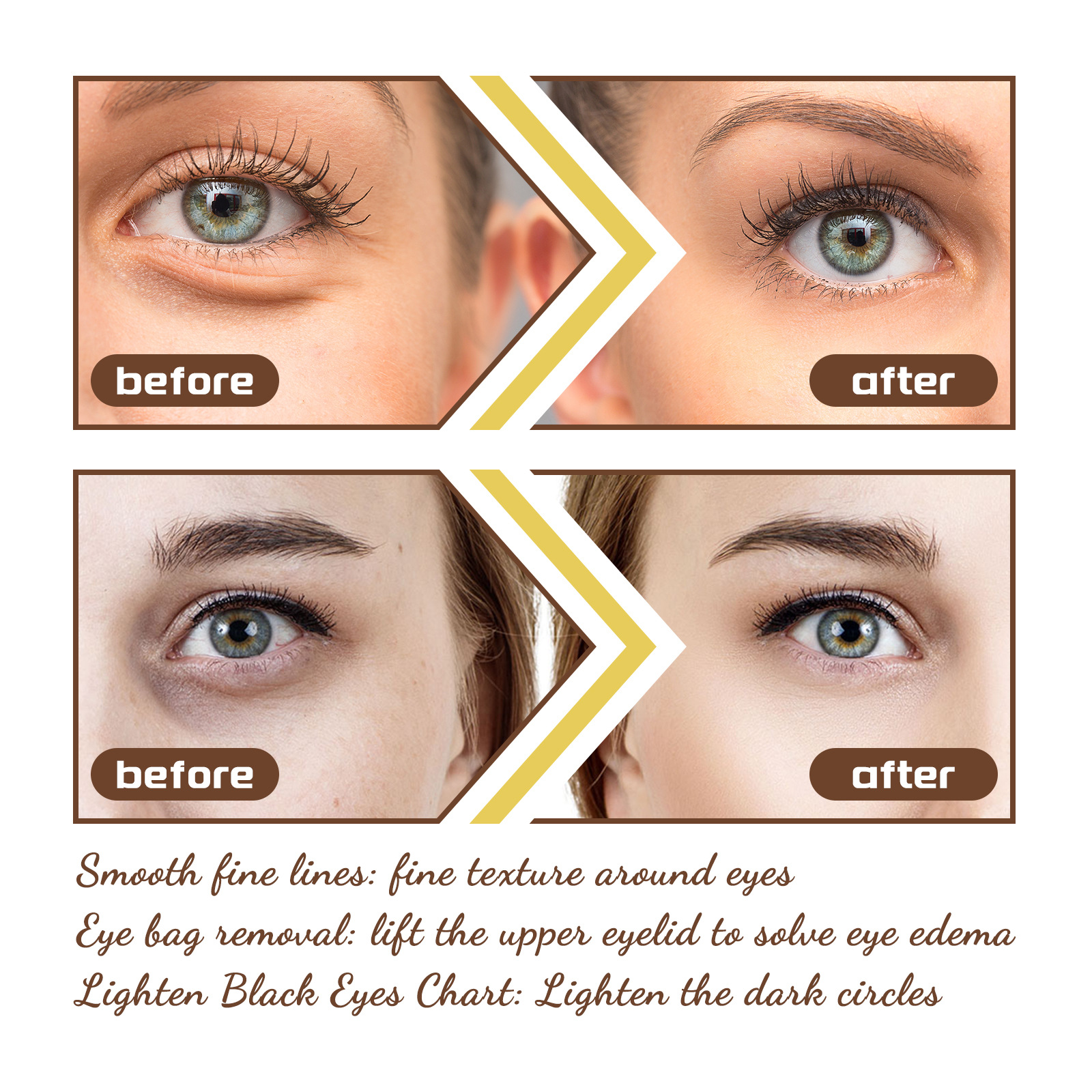 Jayswing Eye Lifting and Firming Eyes, Improving Eyering Fine Dry Lines, Moisturizing essence Liquid_voghion.com