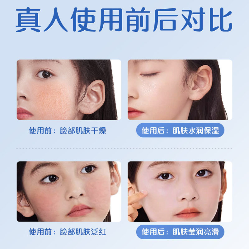 Aoduo 子供用スキンケア製品シリーズは、子供、赤ちゃん、ティーンエイジャー向けの保湿、保湿、肌の色を明るくするスキンケア製品を発送します。|undefined