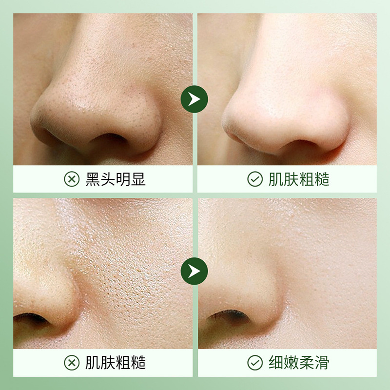 上朵积雪草熬夜四件套 保湿补水嫩肤细腻毛孔护肤品套装礼盒批发|undefined