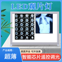 X���Ƭ��CT�˴Źǿƿ�Ƭ��led�^Ƭ���������p�������t���^Ƭ��