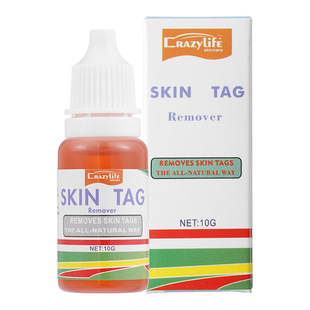 Crazylife cross-border in stock hands and feet foot care solution body 10ml skin tag wart