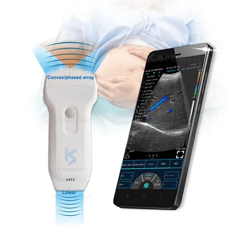 Handheld 3-in-1 Wifi Usb-Compatible Tablet Sdk Data Development Kit Portable Wireless Ultrasound Handheld 3-in-1 Wifi Usb-Compatible Tablet Sdk Data Development Kit Portable Wireless Ultrasound
