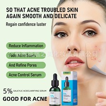 �羳��Ʒsalicylic acid acne removal serumˮ��������AҺOBM