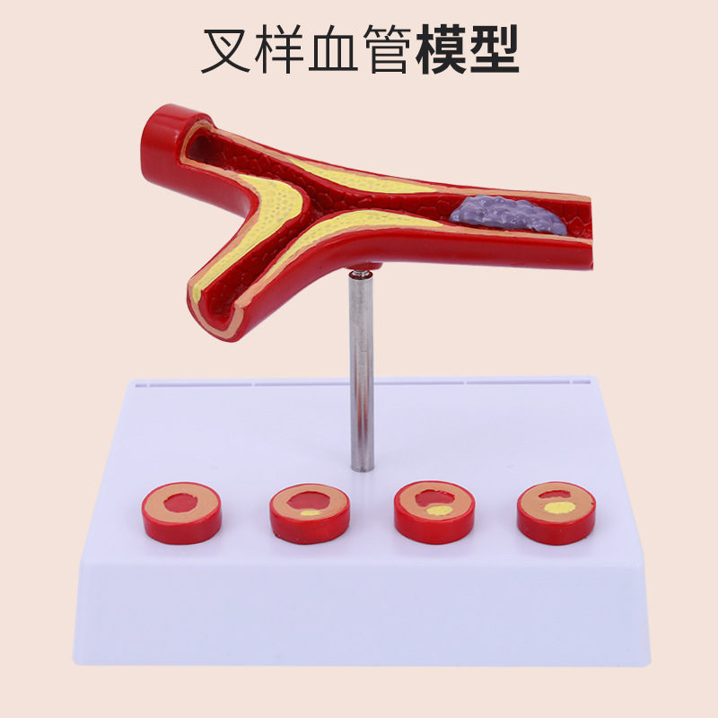 Ѫ��/���� ѪҺŨ��֬�� ����ѪҺ Ѫ������/Ѫ�ܲ������� ģ��