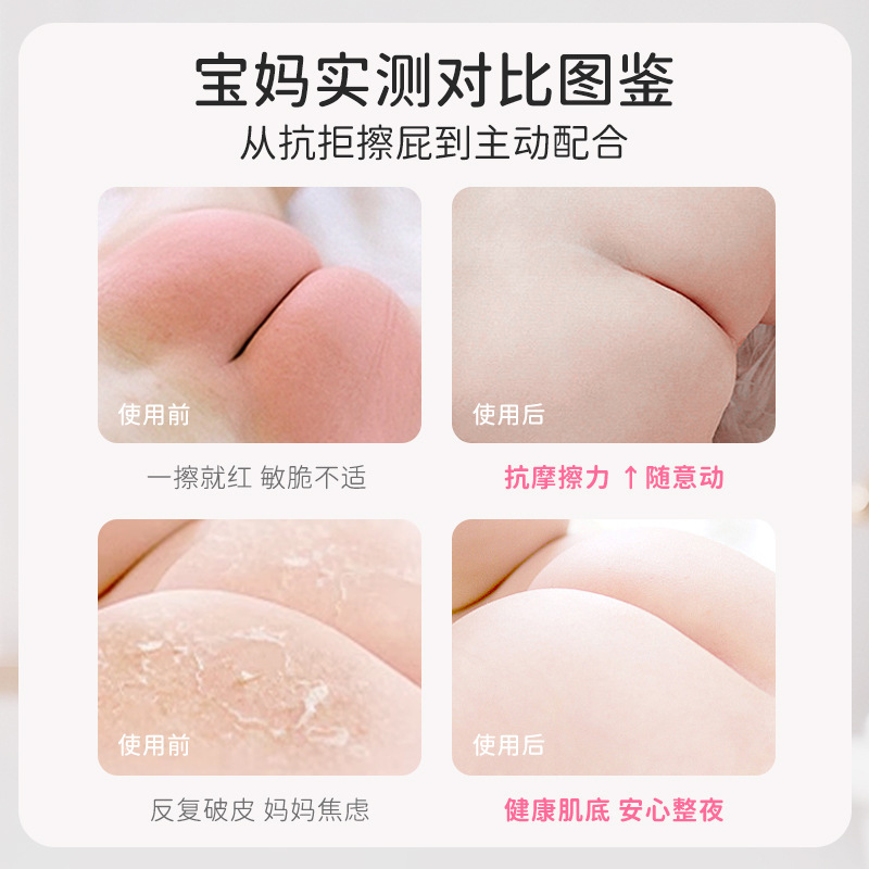 奥朵儿童护臀霜宝宝可用滋润皮肤修护温柔呵护容易吸收儿童保湿霜|undefined