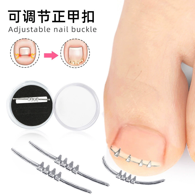 Новая пряжка ногтей фиксированная нога