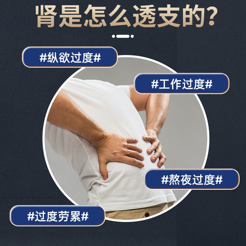 Manufacturer Direct Supply of Ai Shen Patch, Ai Moxibustion Patch, Ai Cao Patch, Ai Yao Patch, Household Wholesale Warm Moxibustion Patch, Kidney-Boosting Health Care Patch