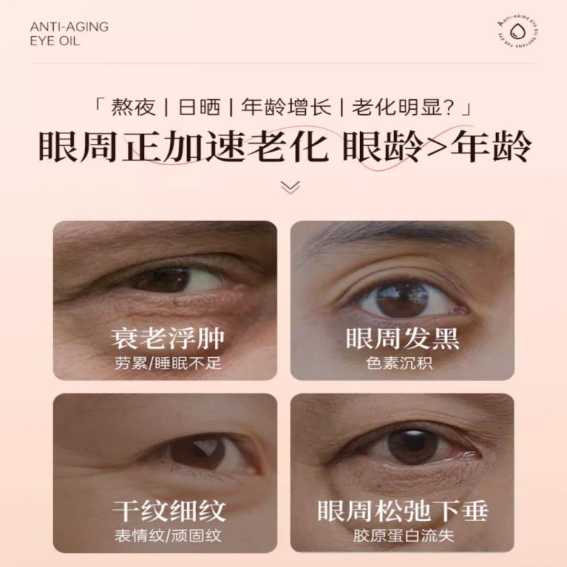 スポット Jingxiutang アイ アンチリンクル アイ オイル 保湿、美白、引き締め 植物エキス エッセンス オイル 目の周りの改善 エッセンス オイル|undefined