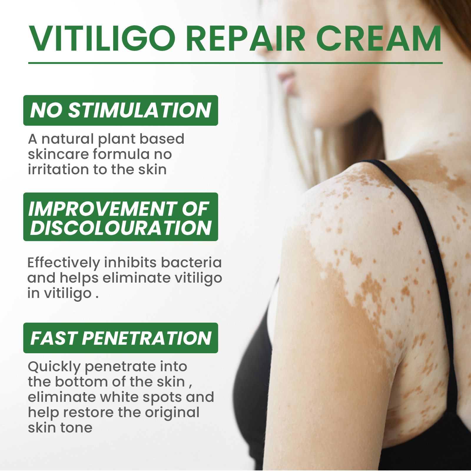 EELHOE Crema riparatrice per applicazioni esterne desalinizzante per macchie di fiori bianchi e pelle di mani e piedi_voghion.com