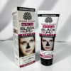 Acne remover from black spots, detachable face mask, pore cleansing, anti-wrinkle, oil sheen control, 120g