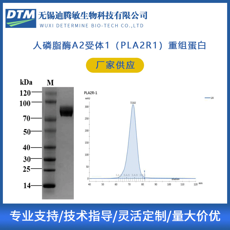 纯化人磷脂酶A2受体1（PLA2R1）重组蛋白 血清试剂 无锡迪腾敏