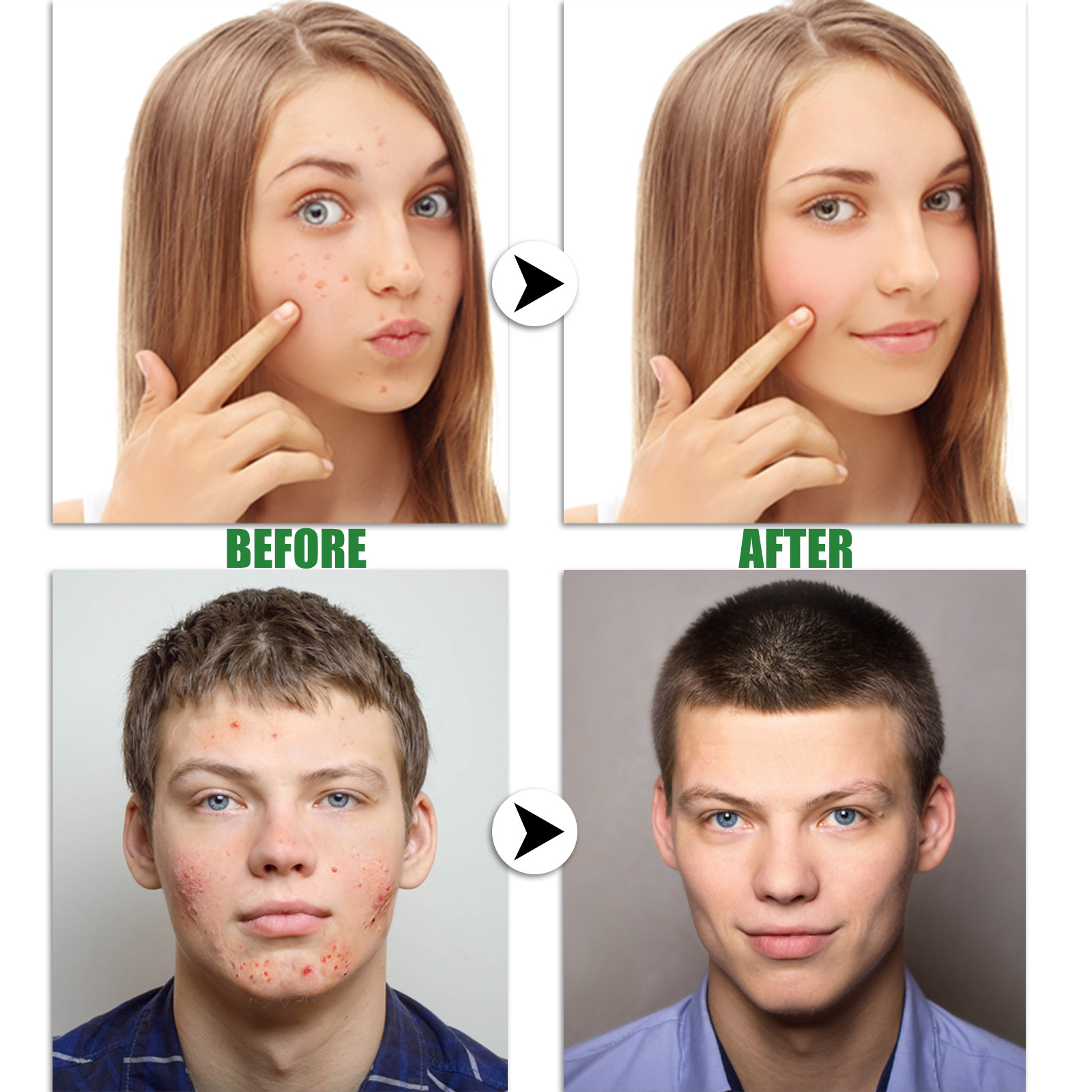 „EELHOE Ac Cleansing Pen“ valomasis pieštukas giliai valo odą, šviesina Ac randus ir atkuria užčiauptos burnos ertmės žaizdas._voghion.com