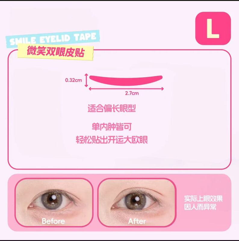 ティヨン泉のほほえみの二重まぶたはステルスを貼って長く持続します。|undefined