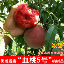 Ѫ���Ҙ������޽��������¼t��������ͥԺ�ϱ��Ϸ��Nֲ����Y��