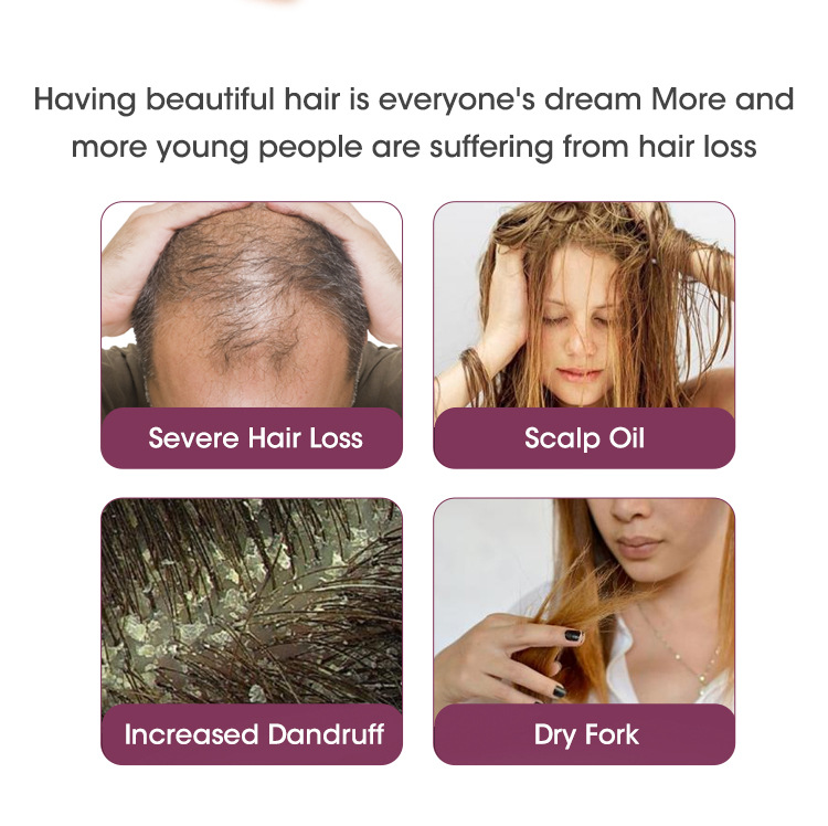 Aceite Esencial de Cebolla Roja