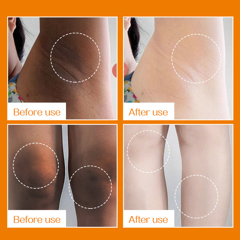 Comercio exterior transfronterizo VC en inglés crema blanqueadora de axilas Gongpei crema para el cuidado del cuerpo de piel suave blanca y negra clara al por mayor