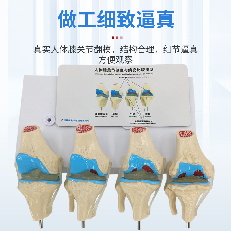 ��̬ ϥ�ؽ�ģ�� �Ľ׶β���ϥ�ؽ�ģ�� ���� ����ϥ�ؽ�ģ��