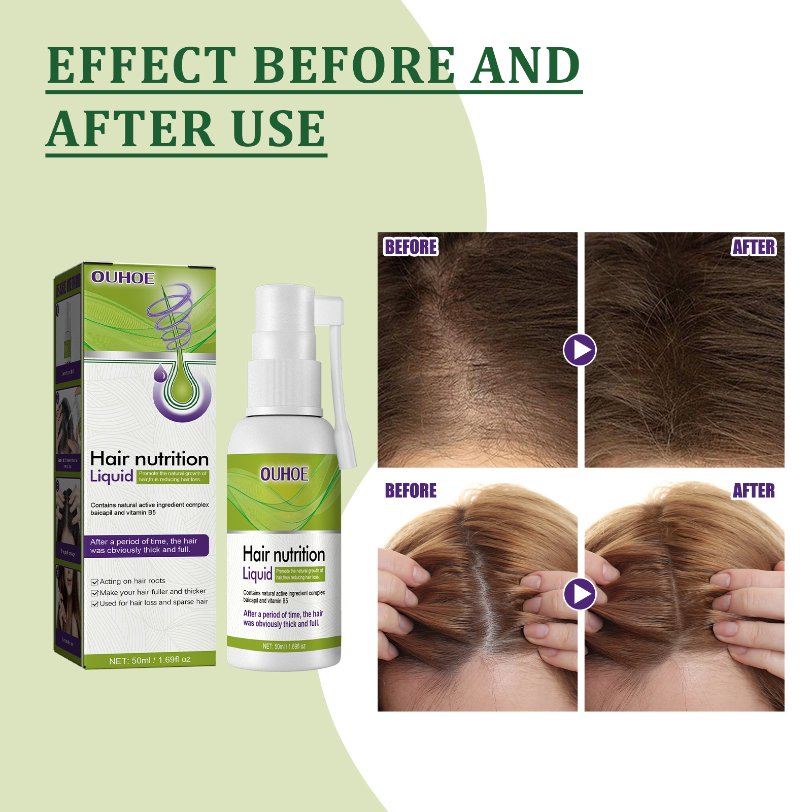 OUHOE Solution de pompe de croissance cuir chevelu nourrissant, cheveux denses et forts anti-cassés, cheveux clairsemés et fixes_voghion.com