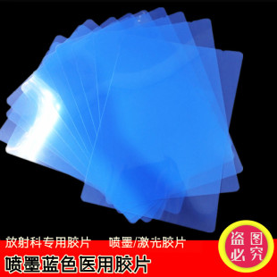 �t���zƬ��ī�{Ƭ�{����ʽ����ƴ�ӡ�zƬ���ƹ���X��Ƭ DR CR CT