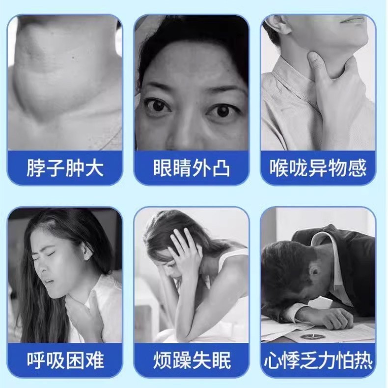 北京銅仁堂ビアンパッチ甲状腺型甲状腺腫大痛み腫れ経穴パッチ不快感を和らげる絆創膏|undefined