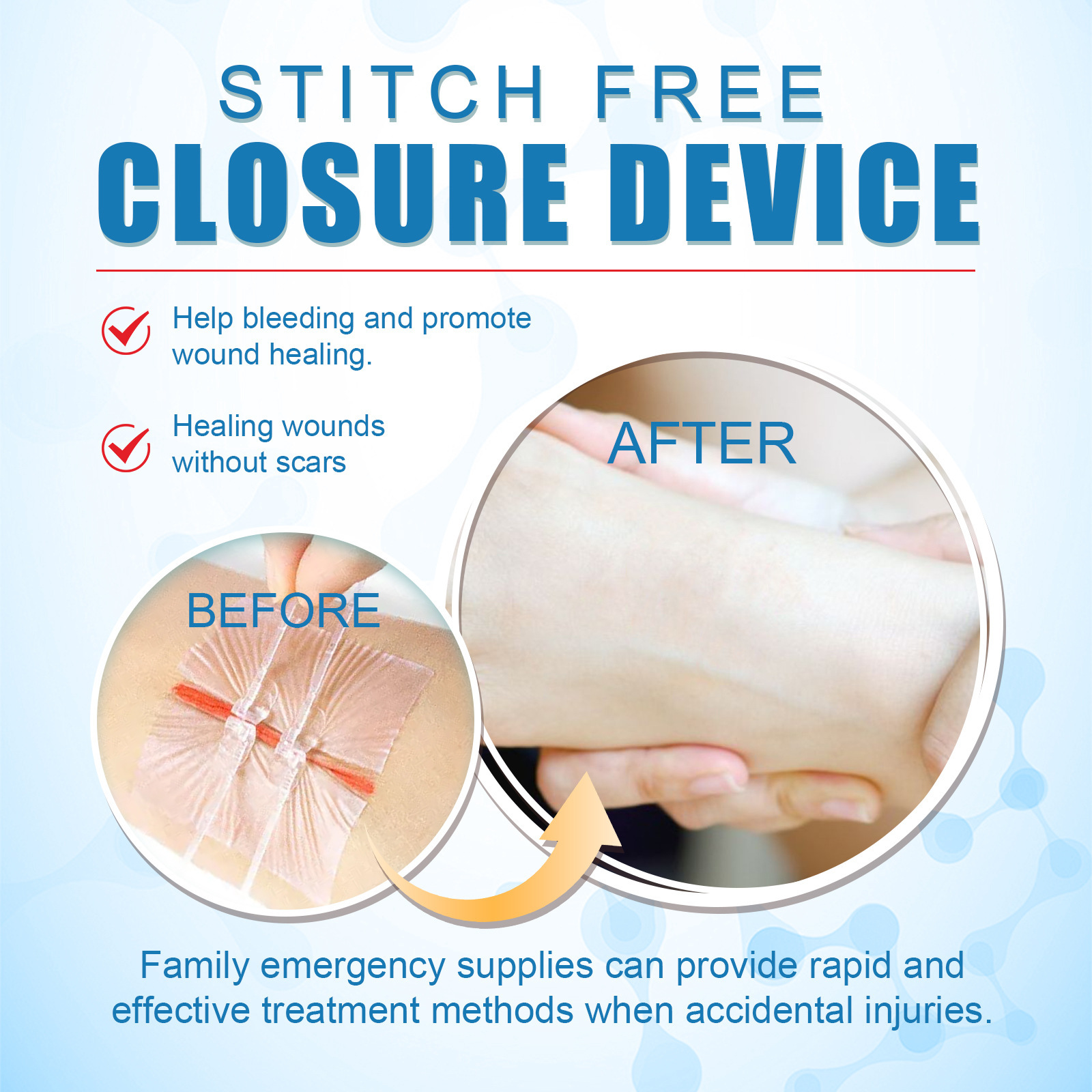 South Moon suturfrit lukkeplaster, suturfrit plaster, hudsårplejeplaster_voghion.com