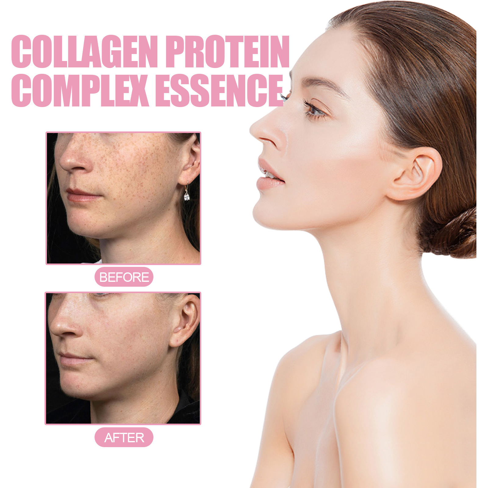 La Solution d'essence de collagène d'essence d'embryon de mouton EELHOE soulève, resserre, améliore le tonus, éclaircit les taches, hydrate et_voghion.com