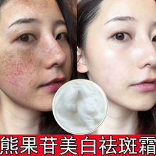 �ܹ���������׵���ȥ�����ȸ���S�ְ��������˪��Чȥ��ɫ��