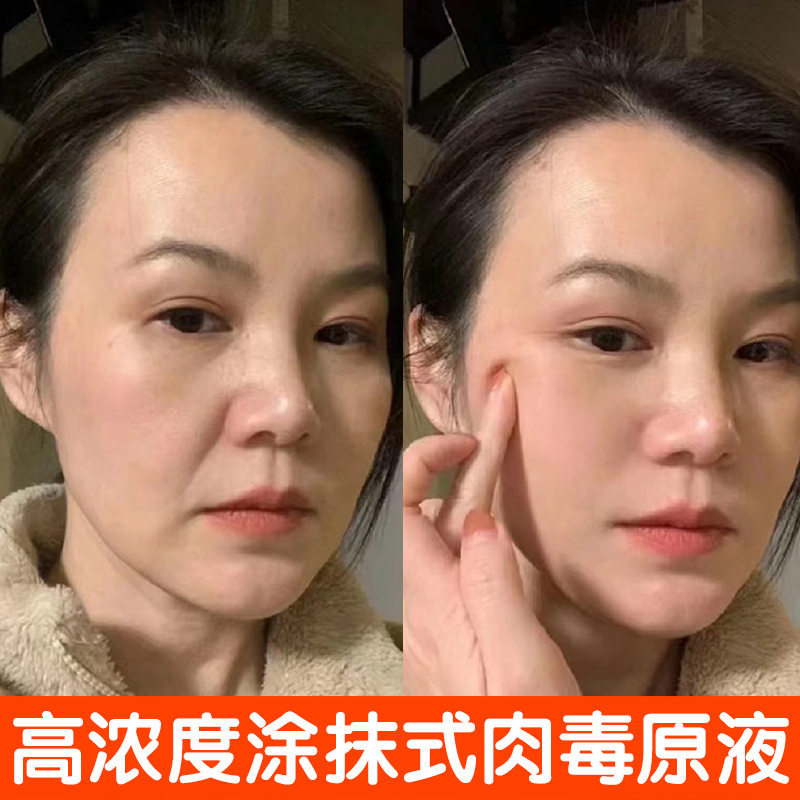スミアタイプのボツリヌス毒素原液、ヘッドラインの小じわを除去する抗シワ引き締めエッセンス、ポリペプチドボツリヌスエッセンス|undefined